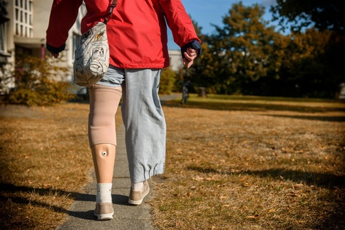 Unsere Patienten Ursula geht mit Beinprothese durch einen Park